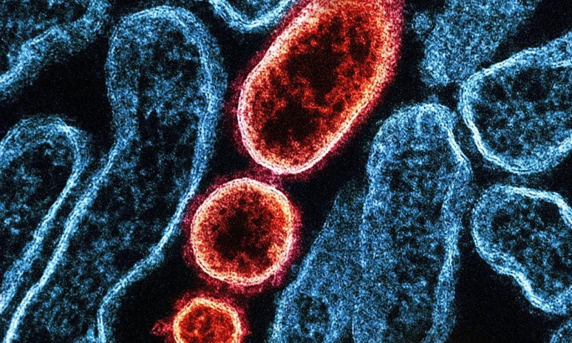 Nipah Virus