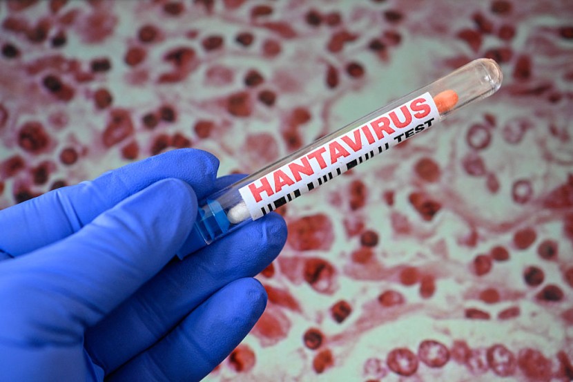 Hantavirus